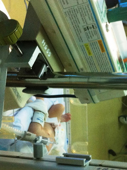 Bé sơ sinh,&nbsp;con trai sản phụ tử vong tại chỗ trong tại nạn giao thông trên&nbsp;Quốc lộ 91 (An Giang), đang được chăm sóc điều trị tại khoa hồi sức sơ sinh, Bệnh viện Nhi Đồng 1 TP&nbsp;HCM.