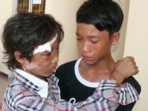 Hai em song sinh Nguyễn Hào Anh- Nguyễn Hào Anh gặp nhau trong nước mắt sau khi Hào Anh bị hành hạ dã man.