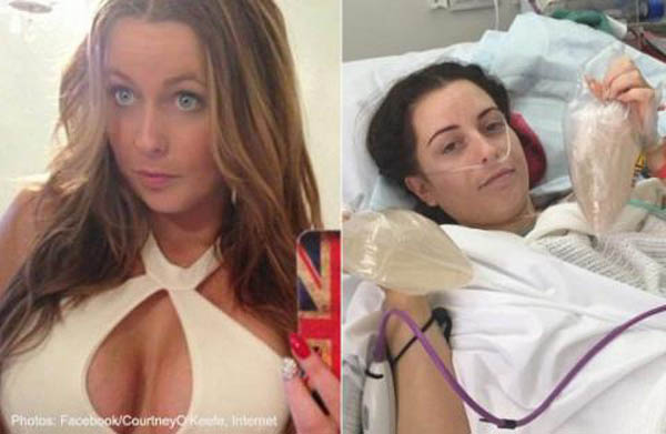 Courtney trước và sau khi điều trị nhiễm khuẩn do nâng ngực ở Thái Lan. Ảnh: Asiaone
