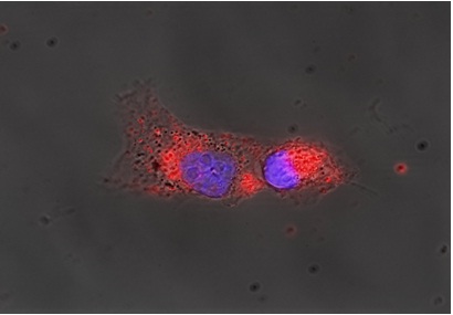 Ảnh chụp kính hiển vi cho thấy sự xâm nhập của Nano Curcumin (Cumargold) vào tế bào ung thư phổi. Ảnh: Viện HLKHCNVN