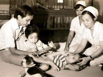 Cặp song sinh Việt - Đức trước khi phẫu thuật.