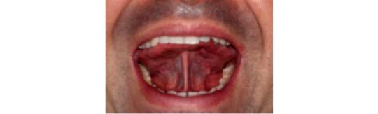 3. Vừa đẩy cuống lưỡi xuống vừa giữ đầu lưỡi chạm vào mặt
trong của răng trước 20 lần.