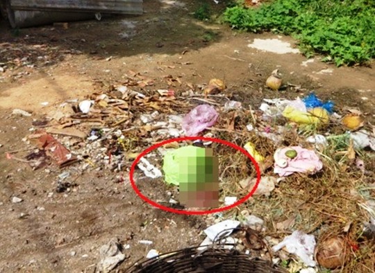 Thai nhi vẫn còn nhau, được vứt bỏ ở bãi rác quận 12 (TP HCM).