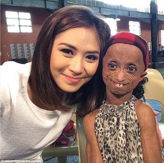 A young woman with a rare and fatal genetic condition has been visited by her idol, Sarah Geronimo (left)
