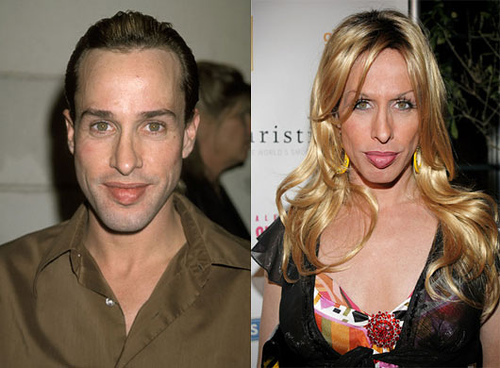 Alexis Arquette từng xuất hiện trong hơn 50 bộ phim. Bộ phim tài liệu về quá trình chuyển giới của cô -