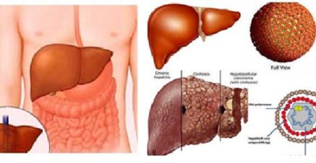 
Ở giai đoạn đầu bệnh gan thường có triệu chứng không đặc hiệu. Ảnh minh họa
