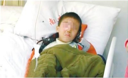 
Bé trai 8 tuổi ở Trung Quốc đã bị tổn thương nặng ở mắt do nghịch hạt chống ẩm.
