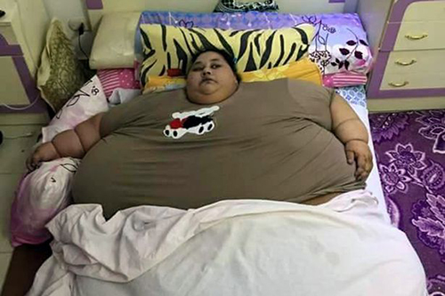 
Iman Ahmad Abdulati được cho là phụ nữ béo nhất thế giới. Ảnh: CEN
