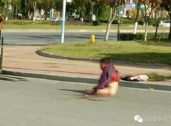 
Bà lão bị không mặc quần ngồi bệt giữa phố. Bà bị đánh đến mức không đứng dậy được, mặt đầy máu.
