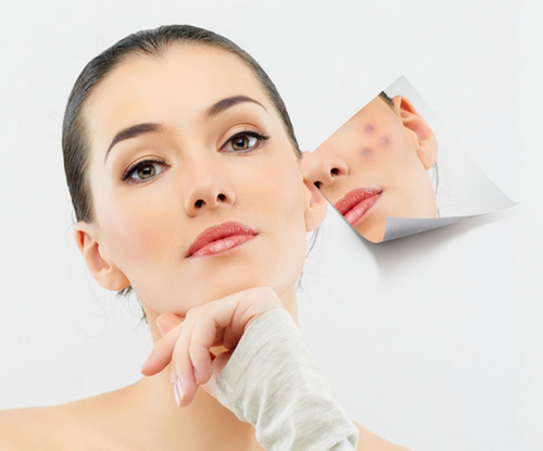 Dùng hỗn hợp này một thời gian, mọi mụn thâm, sẹo sẽ biến mất lúc nào không biết