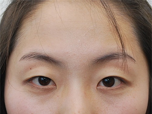 Lông mi ngắn khiến đôi mắt bạn kém lung linh hơn