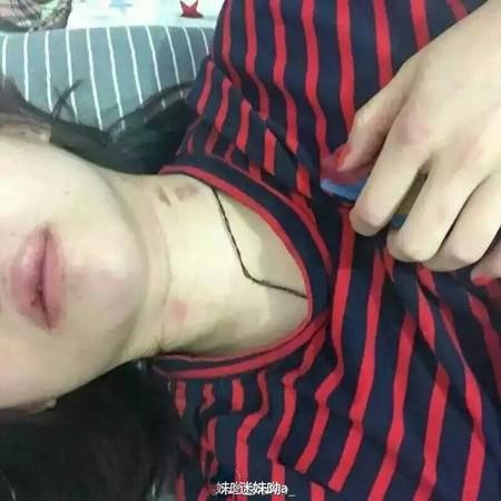 Bạn gái cũ tung bằng chứng bị đánh đập. Ảnh: Sina.