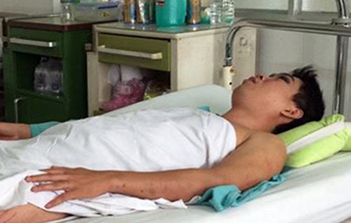 Anh Vang đang điều trị tại bệnh viện. Ảnh: V.S