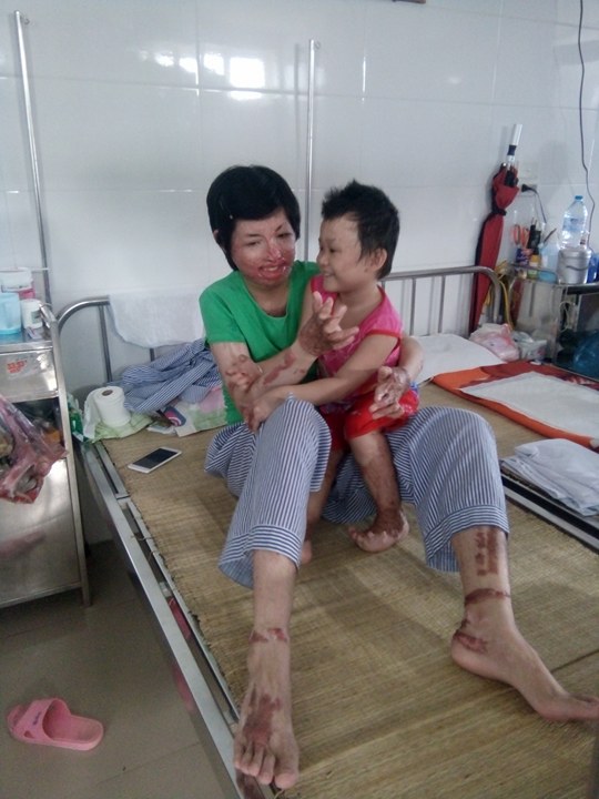 
Chị Hoàng Thị Trang đang chuẩn bị làm phẫu thuật tay. Ảnh: NT
