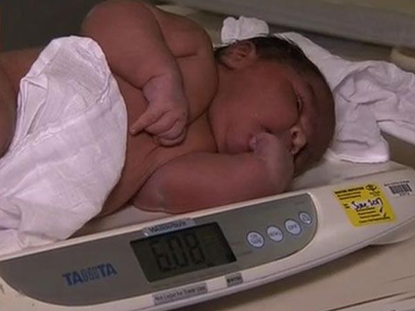 
Em bé sơ sinh ở Úc có cân nặng 6,8kg

