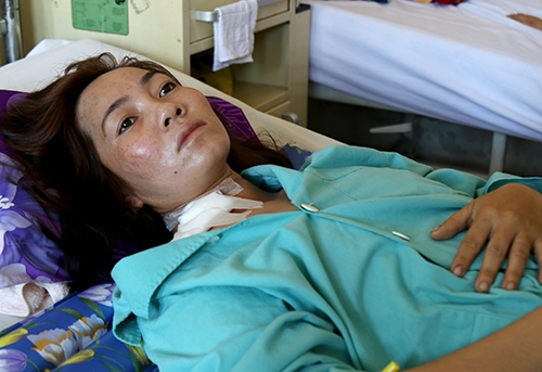 
Người vợ bị chồng truy s&aacute;t được chăm s&oacute;c tại bệnh viện. Ảnh: Xu&acirc;n Ngọc.
