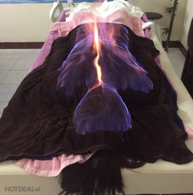 Những người mắc bệnh tim mạch thì không nên dùng hỏa liệu pháp. Ảnh minh họa