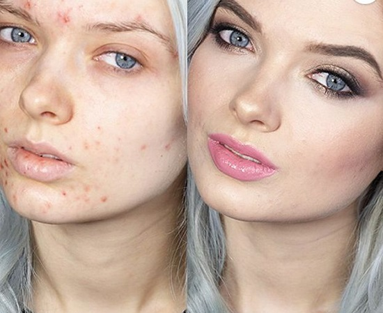 Làn da trước và sau khi sử dụng kem che khuyết điểm