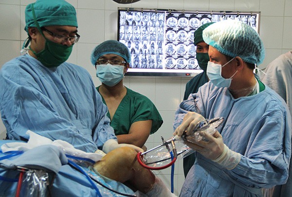 
Các bác sĩ bệnh viện tuyến trên đang tiến hành chuyển giao kỹ thuật phẫu thuật nội soi tái tạo dây chằng khớp gối cho BVĐK tỉnh Lâm Đồng theo Đề án 1816. Ảnh: Lâm Đồng online.
