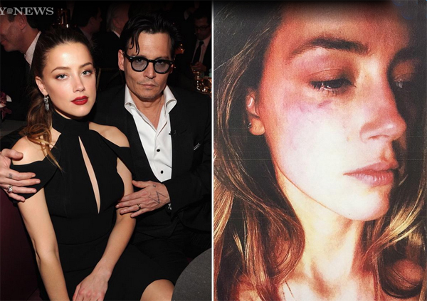 
Vào cuối tháng 5, cô đào Amber Heard bất ngờ đệ đơn ly hôn Johnny Depp chỉ sau 2 ngày mẹ tài tử qua đời. Giữa rất nhiều đồn đoán về nguyên nhân chia tay, Amber xuất hiện ở tòa án Los Angeles với gương mặt thâm tím và tố cáo chồng đã hành hung cô. Người đẹp 30 tuổi cho biết, Johnny với tính hoang tưởng và ghen tuông thái quá đã rất nhiều lần bạo hành cô cả thể chất lẫn tinh thần trong 15 tháng chung sống. Cuộc chiến ly hôn căng thẳng kéo dài gần 2 tháng, cuối cùng đã kết thúc với bản thỏa thuận mà trong đó Johnny Depp phải bồi thường cho vợ 7 triệu USD. Amber đã quyên góp toàn bộ số tiền khổng lồ này cho bệnh viện nhi Los Angeles và giúp đỡ phụ nữ bị bạo lực gia đình.
