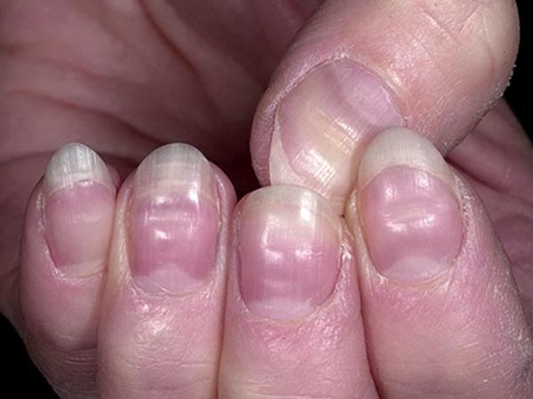 Móng tay: Các nhà nghiên cứu nhận thấy những vi khuẩn gây buồn nôn và tiêu chảy thường được tìm thấy bên dưới móng tay của con người. Vì thế, bạn đừng quên rửa tay thường xuyên nhé!