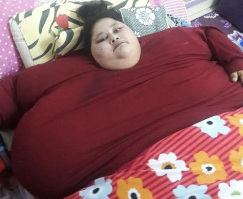 
Eman Ahmed Abd El Aty được cho là nặng 500 kg. Ảnh: Muffazal Lakdawala
