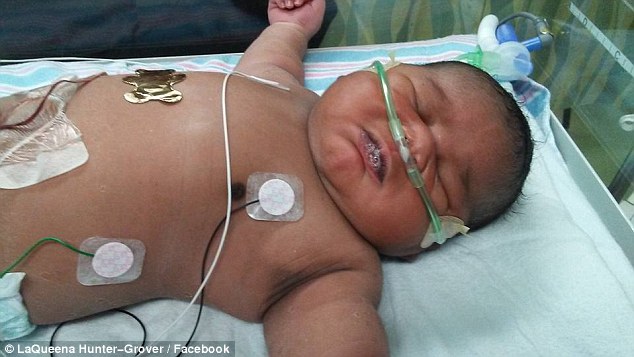 
Bé Loyalty Adonis mới sinh ra đã nặng tới 6,3kg, gấp đôi cân nặng của một đứa trẻ thông thường.
