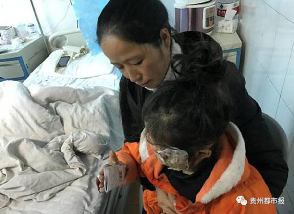 
Cô bé Yun điều trị trong bệnh viện.
