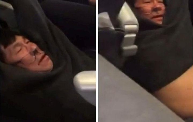 
Hành khách gốc Việt David Dao bị thương sau khi bị kéo lê trên máy bay của hãng United Airlines (Ảnh: Reuters)
