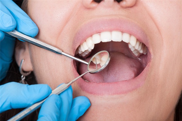 
Đột nhiên lại có nhiều răng sâu, điều đó có thể là một dấu hiệu cho thấy cơ thể bạn đang gặp rắc rối trong việc xử lý glucose. (Ảnh minh họa)
