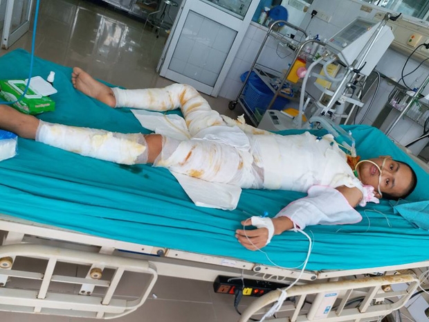 Tiến Anh đã hồi tỉnh sau 20 ngày hôn mê, nguy kịch.