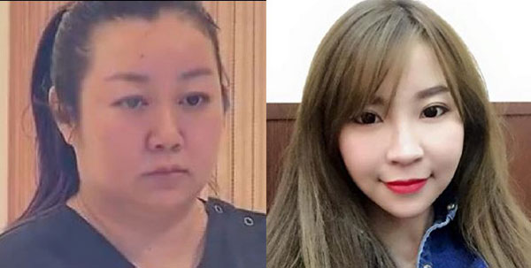 
Bác sĩ Shao (ảnh trái) đã gây ra sai sót trong cuộc phẫu thuật nâng ngực dẫn đến cái chết của Huang (ảnh phải).
