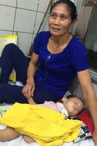 
B&eacute; trai bị rắn cắn đang điều trị tại viện. Ảnh: B.V.
