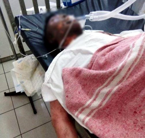 
Nam thanh ni&ecirc;n nhập viện trong t&igrave;nh trạng bị bỏng to&agrave;n th&acirc;n. Ảnh: K.T.
