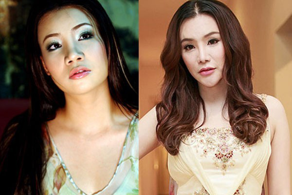 Đôi môi cũng được người đẹp can thiệp để có được dáng môi tều gợi cảm, thay vì dáng môi dày trước kia.