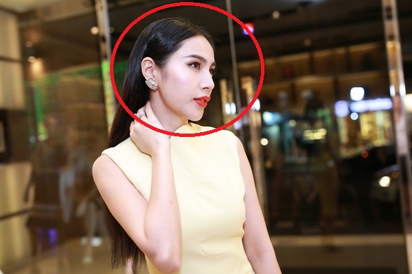 Khuôn mặt căng bóng có dấu hiệu phù của Thủy Tiên. Đặc biệt, khi nhìn nghiêng, khuôn mặt của cô còn lộ ra vẻ bất thường hơn.