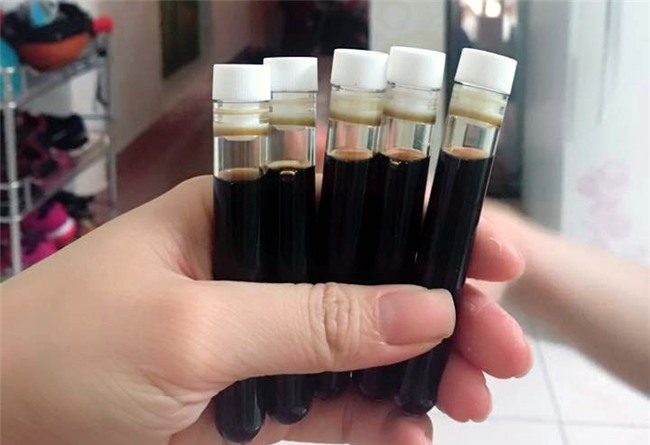 Không rõ người bán lấy máu lươn như thế nào, bảo quản ra sao, pha chế với các loại thuốc nam gì,... liệu có ảnh hưởng đến sức khỏe và sắc đẹp của chị em?