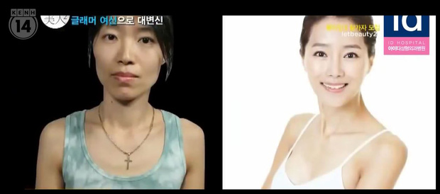 
Hình ảnh của cô Park (bên trái) trước và sau phẫu thuật.
