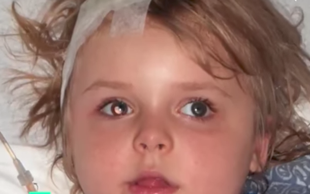 
Autumn Michaels khi 7 tháng tuổi có khối u não gần dây thần kinh thị giác. (Ảnh: FS)
