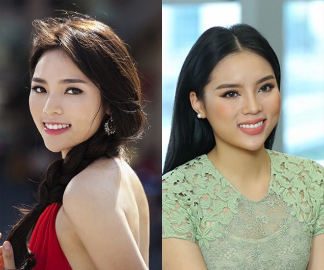 Kỳ Duyên dính nghi án phẫu thuật quá nhiều đường nét trên khuôn mặt. Tuy nhiên điều đáng tranh cãi là hoa hậu từng nói, vì bị sốt mà mặt và môi cũng sưng mọng theo.