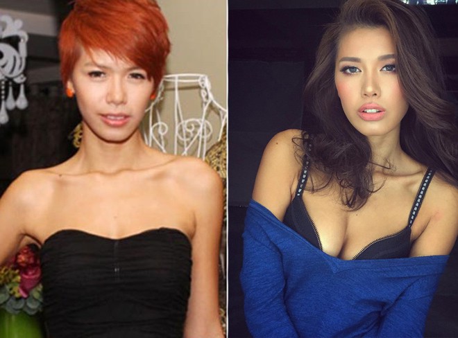 Minh Tú – giải bạc Siêu mẫu Việt Nam 2013 có đôi môi ngày một dày mọng, khác biệt hẳn trước kia.