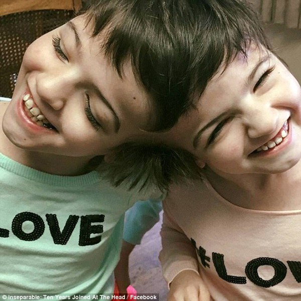 Tatiana và Krista trong sinh nhật 10 tuổi. Ảnh: CBC.
