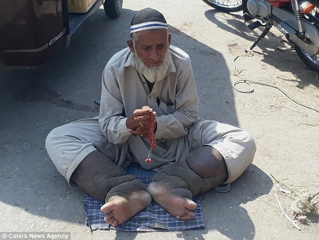 &Ocirc;ng Muhammad Saleem kiếm sống bằng nghề ăn xin tr&ecirc;n đường. Ảnh: Caters News Agency.