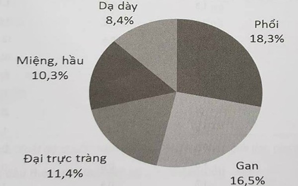 
5 loại ung thư thường gặp nhất ở nam giới.
