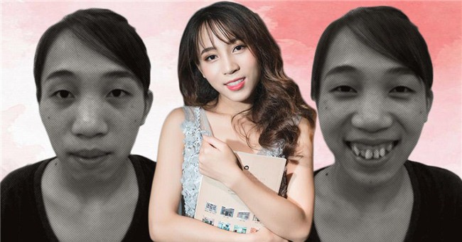 Câu chuyện dưới đây cũng có mô típ tương tự, sinh ra ở ngoại ô thành phố, cô gái trẻ với đam mê âm nhạc luôn rơi vào trạng thái tự ti, khép mình vì vẻ ngoài không mấy ưa nhìn. Thậm chí, diện mạo ấy còn khiến cô nhận phải lời trêu trọc tàn nhẫn từ bạn bè như khỉ đột rừng Amazon. Những lời nói không suy nghĩ ấy khiến em tổn thương vô cùng. Em gần như mất hết tự tin, vì làm gì cũng xấu hổ và không bao giờ cảm thấy thoải mái ở chỗ đông người. Lên đại học em vẫn bị trêu chọc, xin đi làm thêm nhưng khó khăn lắm mới có một nơi nhận. Bàn Thúy Toàn buồn bã chia sẻ.