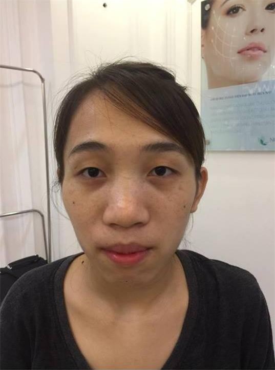9x chia sẻ cô từng có khoảng thời gian bị khủng hoàng vì không chịu được áp lực xung quanh đến mức cô cảm thấy không hài lòng với bất kì thứ gì trên khuôn mặt mình. Em từng nộp hồ sơ vào một shop bán quần áo. Sau khi gặp, người ta nói khéo luôn là về chờ báo kết quả nhưng chờ hoài, chờ mãi chẳng có ai gọi. là một trong những tình huống khó xử mà Thúy Toàn rơi vào.
