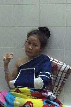 Hung thủ Chi.
