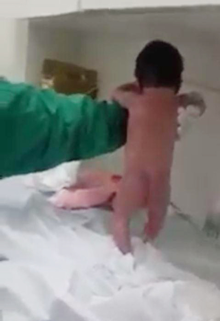 
B&eacute; g&aacute;i c&oacute; thể đứng thẳng d&ugrave; nữ hộ sinh chỉ đỡ bằng một tay.
