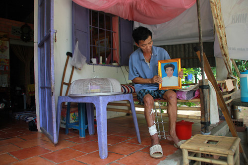 Một người đ&agrave;n &ocirc;ng ở H&agrave; Tĩnh bị chấn thương sọ n&atilde;o do tai nạn giao th&ocirc;ng, sau khi bệnh viện trả về nh&agrave; để lo hậu sự v&igrave; ti&ecirc;n lượng xấu, đ&atilde; đột nhi&ecirc;n sống lại trước giờ kh&acirc;m liệm.