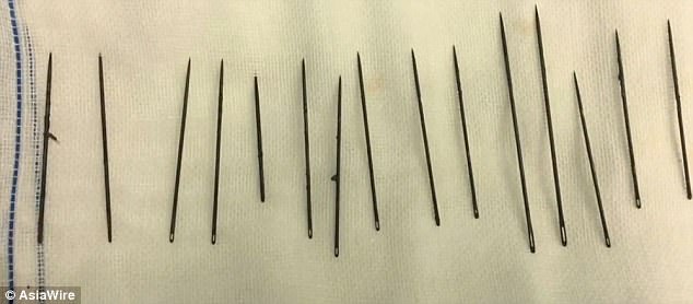 
15 chiếc kim kh&acirc;u được lấy ra từ dương vật bệnh nh&acirc;n. Ảnh: AsiaWire.
